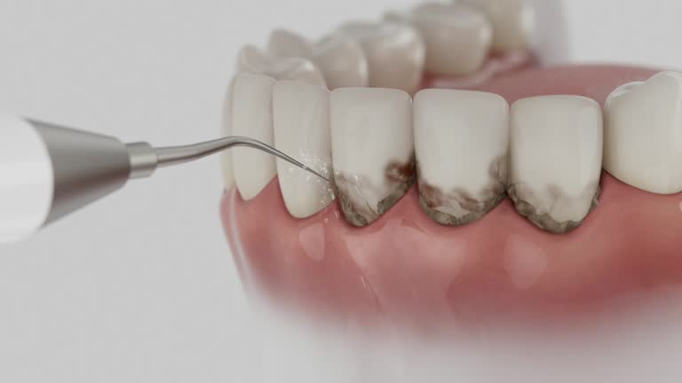 Trusted Wisdom Tooth Removal service in Fair Lawn, NJ - Dentist Open Now